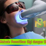 Seputar Metode Pemutihan Gigi dengan Sinar Laser