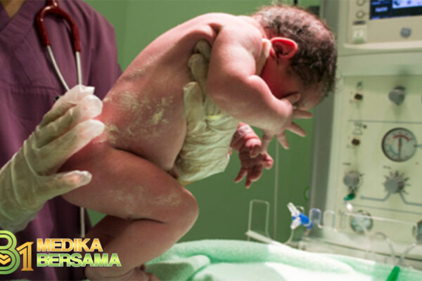 Makrosomia, Kondisi Saat Bayi Lahir dengan Berat Badan Berlebih